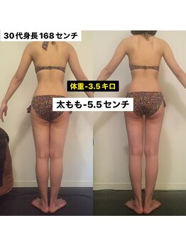 レナトゥス 銀座(Renatus)/美脚コース【痩身/東京/銀座】