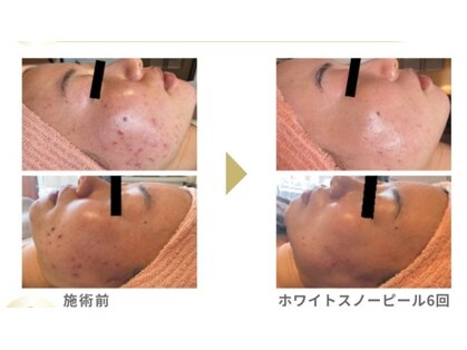 ルリアン(LeLien)の写真