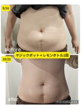 ボンズ(bonds.)/レモンボトル1回の効果です！