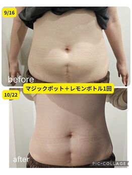 ボンズ(bonds.)/レモンボトル1回の効果です!