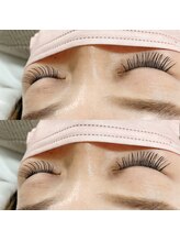 ヌン(NUN.)/フラットラッシュカラー