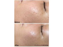 ちらちゅら/クリスティーナ【アンストレス】