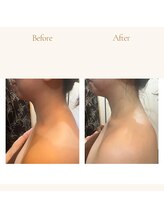 エードット 銀座(A.)/before　→　after