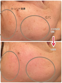 芹花 鹿の子台 (SERIKA)/毛穴・小シワ改善