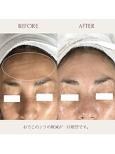 クラームビューティー(Clerm beauty)/リアボーテハーブトリートメント