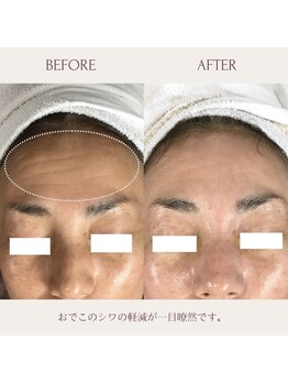 クラームビューティー(Clerm beauty)/リアボーテハーブトリートメント