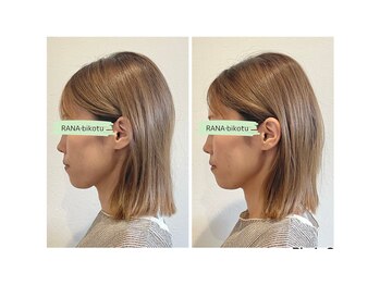 ラーナビコツ(RANA-bikotsu)/【整顔】小顔矯正