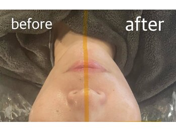 アリアンド(ari.and)/乳酸菌のチカラで美肌効果