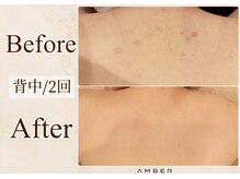 アンバー 恵比寿(AMBER)の雰囲気（【ボディハーブピーリング】お肌に合わせて徹底アプローチ）