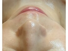 エメ(Eme)の雰囲気（お孫さんいらっしゃるお客様♪毎月のハーブ施術でピカピカ肌です）