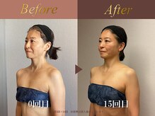 オーシャン(Ocean)/全身美容矯正120分/週1回×15回