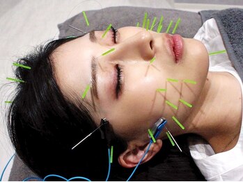 ミトノウ(MITONOU)の写真/最新！美容鍼で内側から輝くハリ・ツヤ【速攻リフトUP】お顔のコリ/たるみケア/くすみ解消！若々しい印象へ