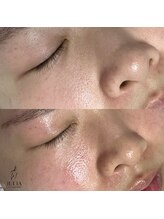 ジュリア(JULIA)/フェイスWAX（ワックス）