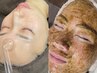 プラズマ×ヒト幹細胞ハーブピーリング◆毛穴洗浄付 ￥17000→