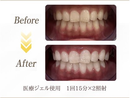 ホワイトニングプラス 六本木店の写真