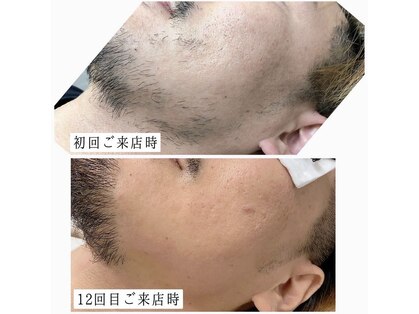 するり(SuRuri)の写真
