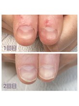 グレースレディ 神戸北店/