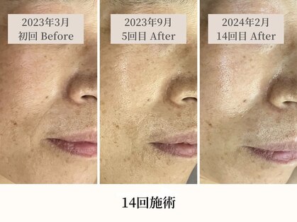 イト(ito)の写真