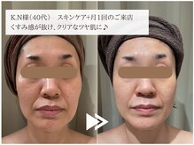 レイテノール 藤沢店