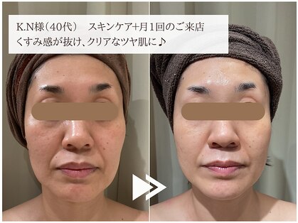 レイテノール 藤沢店の写真