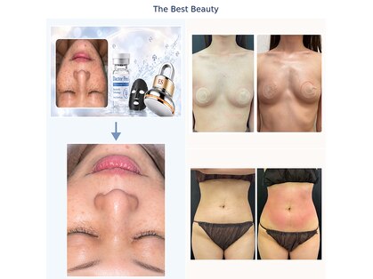 ザ ベスト ビューティー(The Best Beauty)の写真