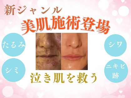 ルアナ(Luana.)の写真