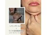 【小顔/二重アゴケア】ラジオ波搭載小顔施術+レモンボトル2ｃｃ　14,300円