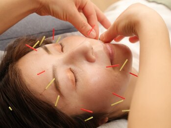 すわ鍼灸整骨院の写真/【美容鍼でリフトUP☆】今話題の美容鍼をぜひ当院でお試しください◎ベテラン技術者による施術♪