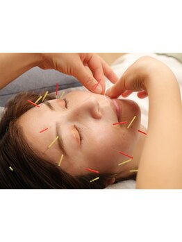 鍼灸施術を受けたい