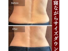 エイプリルの雰囲気（Wキャビテーション×W超音波×EMSで理想のボディが手に入る♪）
