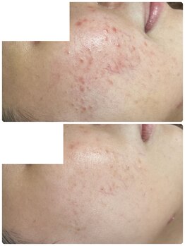 リノ(Lino)/オーダーメイド