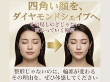 ラウレア(Laule'a)