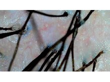 ミノオビュートガーデン(MINOH BEAUT garden)/