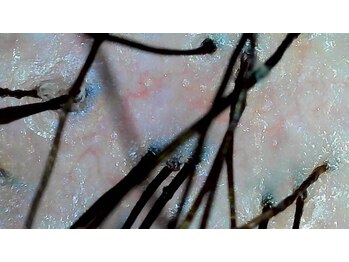 ミノオビュートガーデン(MINOH BEAUT garden)/