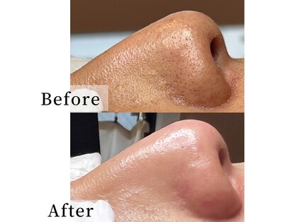 癒える(ielu)の写真