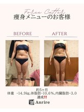 アンリール 旭川店(Anrire)/BODY施術のお客様です！