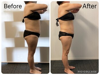 ラヴィアンローズ 津島店(La vie en Rose)/◇ビフォーアフター◇