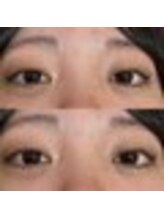 バニーアイズ 天神(Bunny eyes TENJIN)/トリートメントラッシュカール