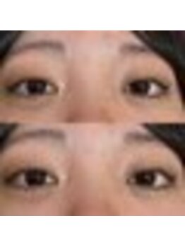 バニーアイズ 天神(Bunny eyes TENJIN)/トリートメントラッシュカール