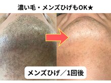 NTエステティック 西条店の雰囲気（丁寧な施術で、たしかな効果♪）