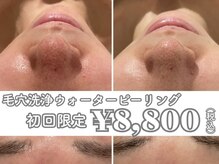イデアルミー 大宮店(イデアルMe)の雰囲気（毛穴レス美肌・小顔・ハーブピーリングお任せください(^^)♪）