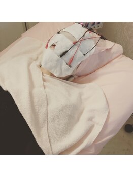 ミスティー(Misty)/スーパー美白&スペシャルコース