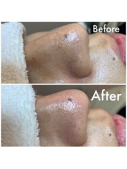 ウエカ(ueka)/黒ずみ汚れ!