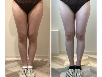 エイシスグロウ(asis glow.)/効果写真