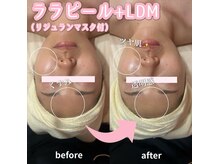 サロン(SALON)/ララピール+LDM