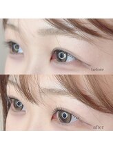 フェイスネイル(face＆nail)/人気No.1 パリジェンヌ