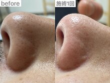 ユイット ルッカ(Huit Lucca)/ハイドラ×ララピール