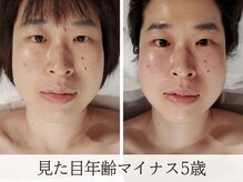 ミピマムマール(Mipimam Maaru)の雰囲気（初回から効果実感！仙台コルギ/仙台小顔）