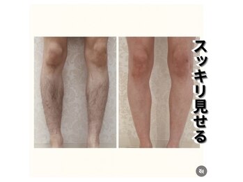 バーグトータルビューティー(bague total beauty)/メンズパーツ脱毛で清潔感UP!