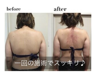 ラ ヴォワ 東銀座(La Voix)の写真